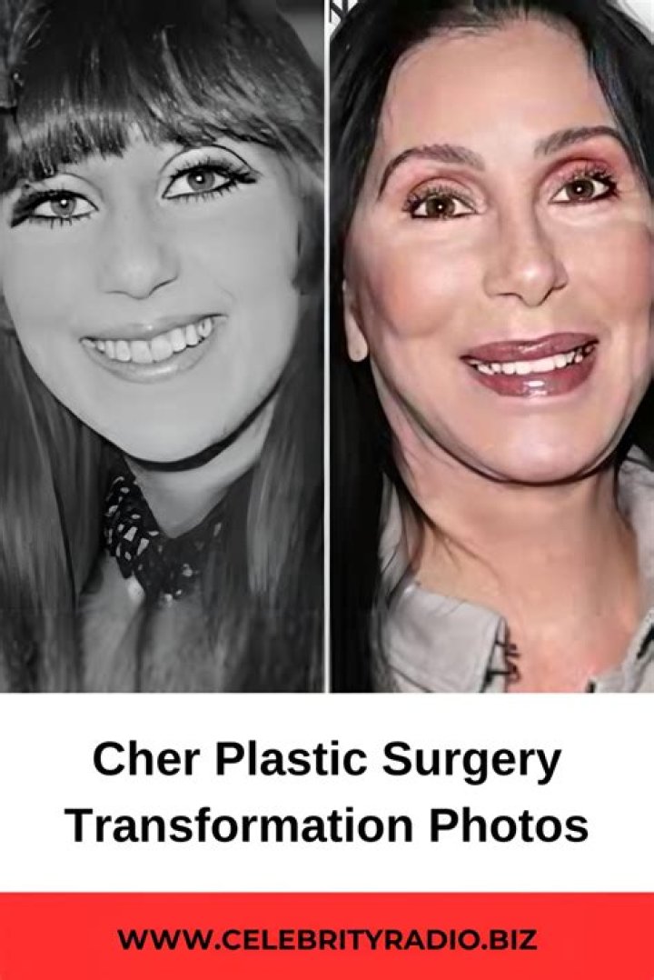 Five Cher Plastic Surgery Jokes on Twitter That Even Cher Would Like