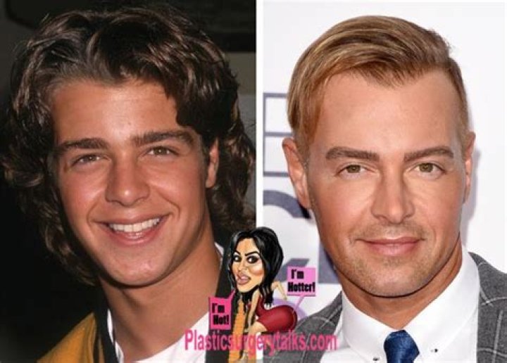 Joey Lawrence Plastic Surgery: Did He Get A Botox? Physical Appearance