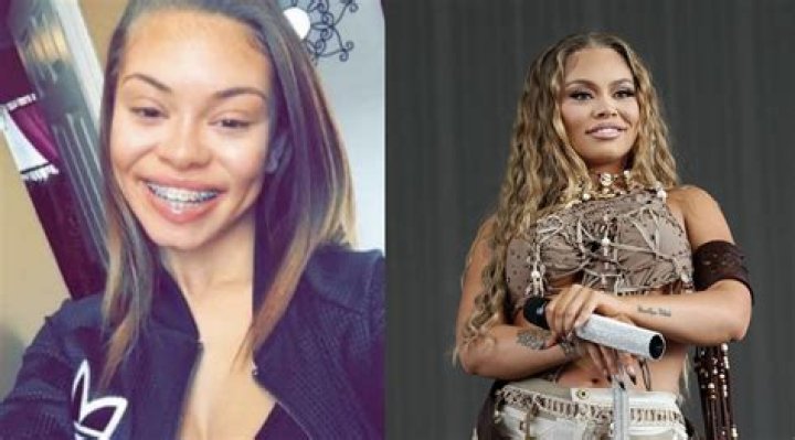 Latto Before And After Surgery – Did She Underwent Plastic Surgery? And Health Update