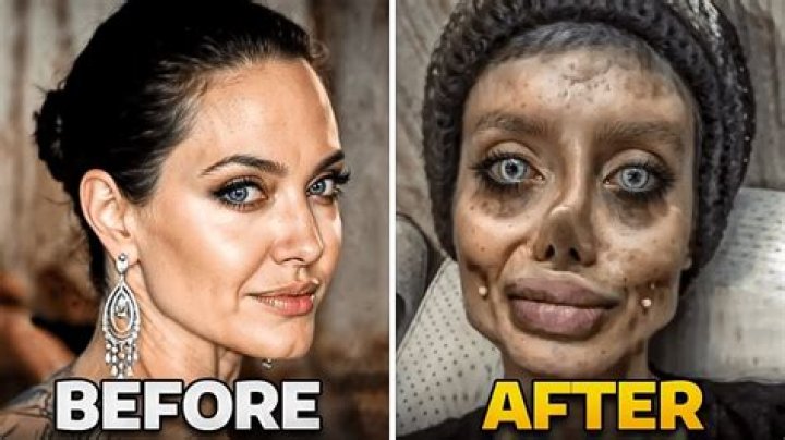This Actor is Unrecognizable After His Plastic Surgery